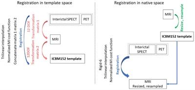 Image synthesis of interictal SPECT from MRI and PET using machine learning